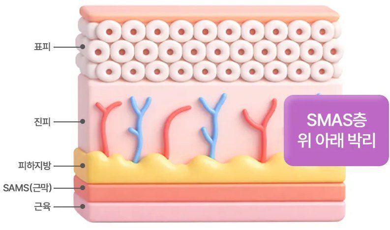 표피, 진피, 피하지방, SMAS층, 근육 구조를 보여주는 피부 단면 3D 일러스트