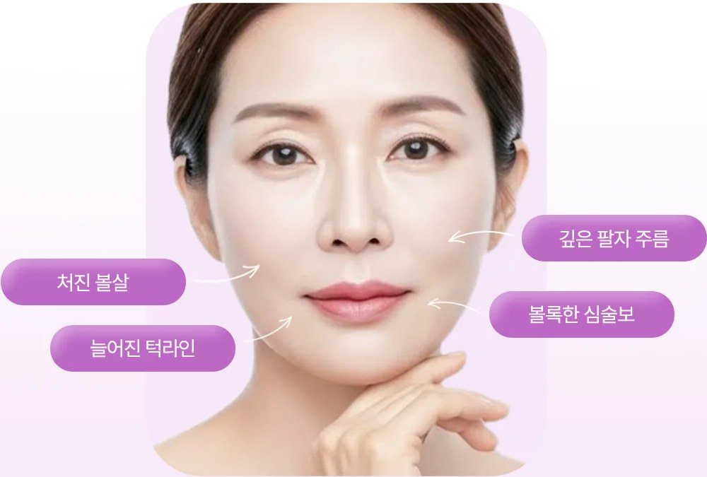 노화 고민 부위(깊은 팔자 주름, 볼록한 심술보, 처진 볼살, 늘어진 턱라인)가 표시된 여성 얼굴 사진