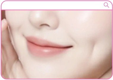 긴 보조개 시술 예시