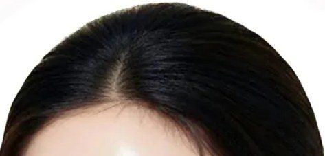 여성 모델의 이마와 머리카락 부분