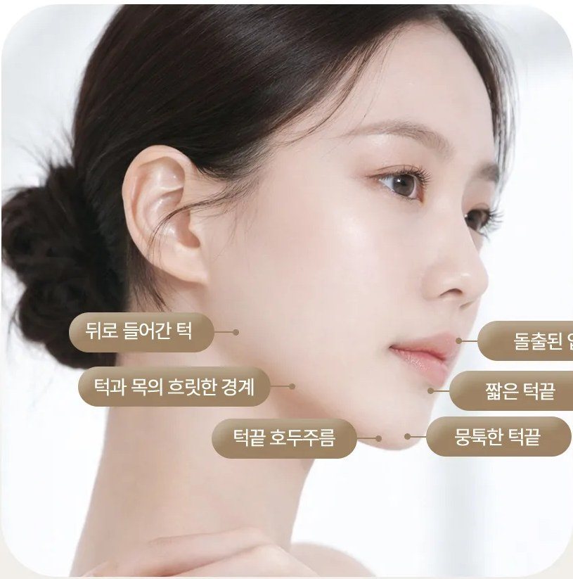 무턱 고민 부위(뒤로 들어간 턱, 턱과 목의 흐릿한 경계, 턱끝 호두주름, 돌출된 입, 짧은 턱끝, 뭉툭한 턱끝)가 지칭된 여성 측면 얼굴