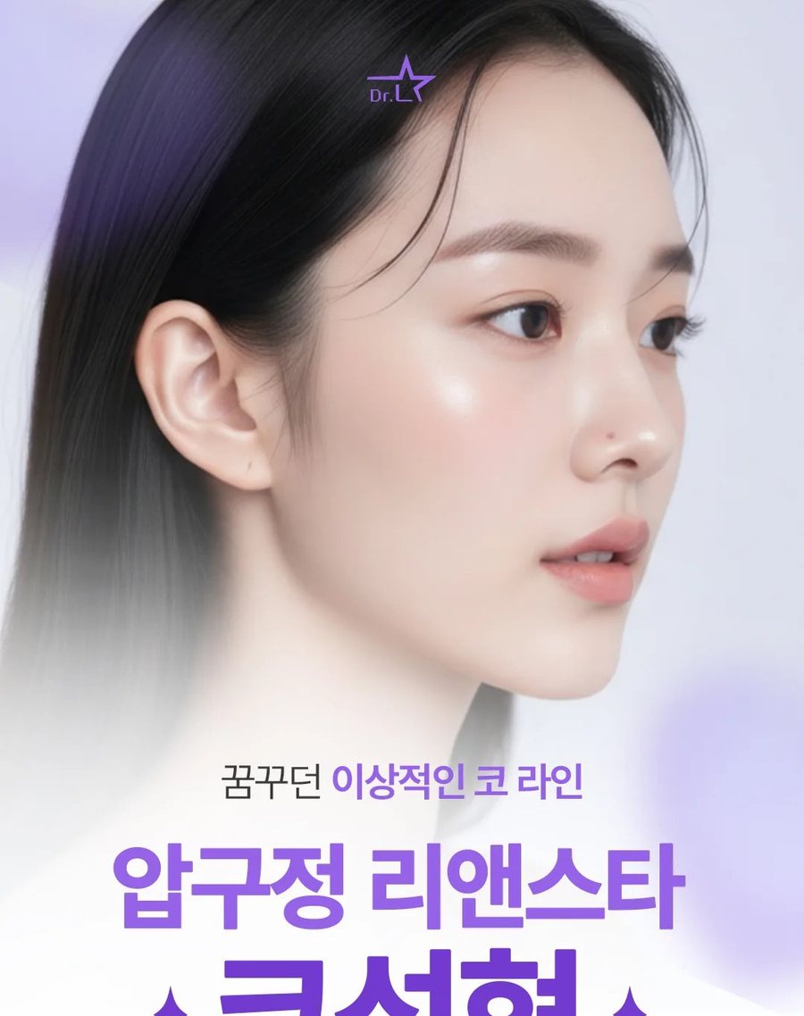 코성형