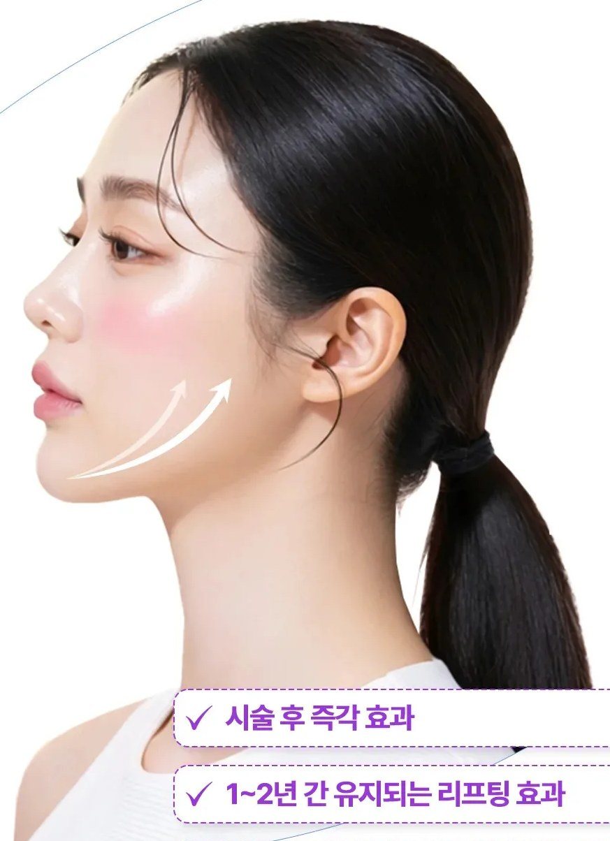 턱선에 리프팅 방향을 나타내는 화살표가 그려진 여성의 옆모습