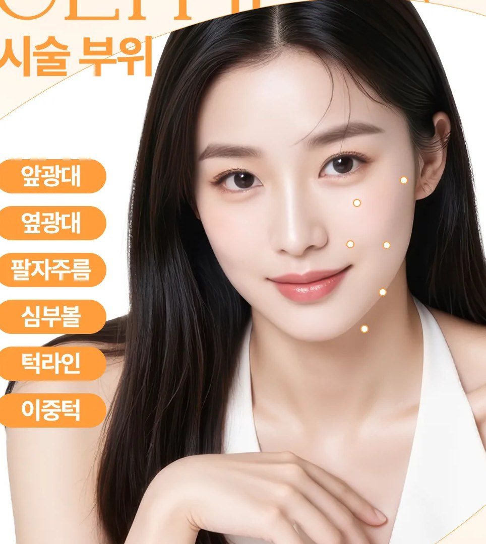 시술 부위 포인트가 표시된 여성 얼굴 사진
