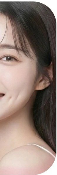 보조개 시술 모델 좌측 사진
