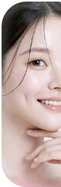 보조개 시술 모델 우측 사진