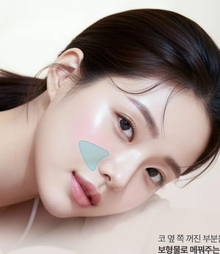 코 옆 귀족수술 부위가 표시된 여성 얼굴