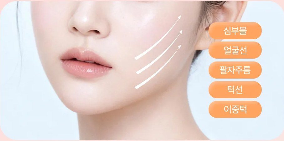 리프팅 방향 화살표와 시술 부위(심부볼, 얼굴선, 팔자주름, 턱선, 이중턱)가 표시된 여성 얼굴