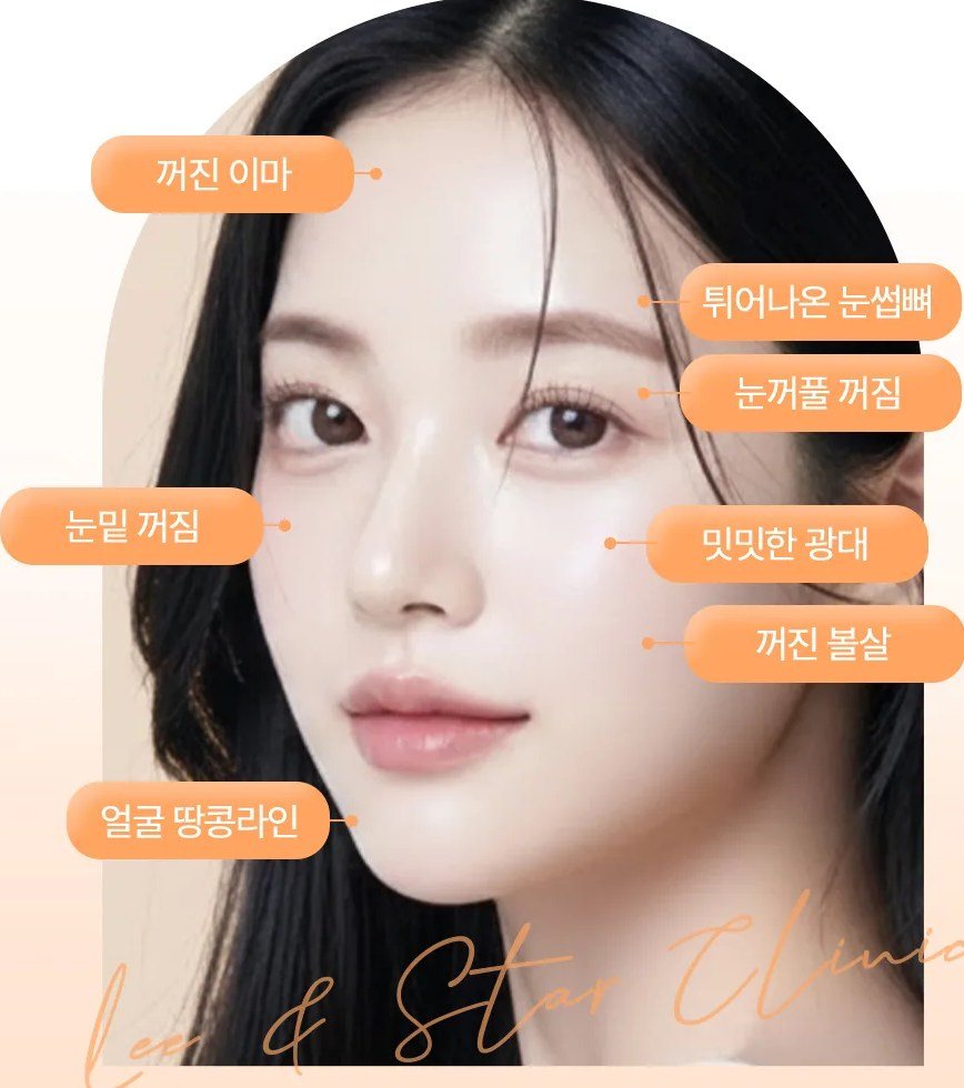 얼굴 부위별 지방이식 포인트(꺼진 이마, 튀어나온 눈썹뼈, 눈꺼풀 꺼짐, 눈밑 꺼짐, 밋밋한 광대, 꺼진 볼살, 얼굴 땅콩라인)가 표시된 여성 