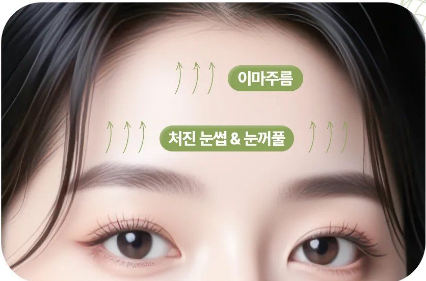 이마주름과 처진 눈썹 및 눈꺼풀 개선 방향을 보여주는 여성 눈매 일러스트